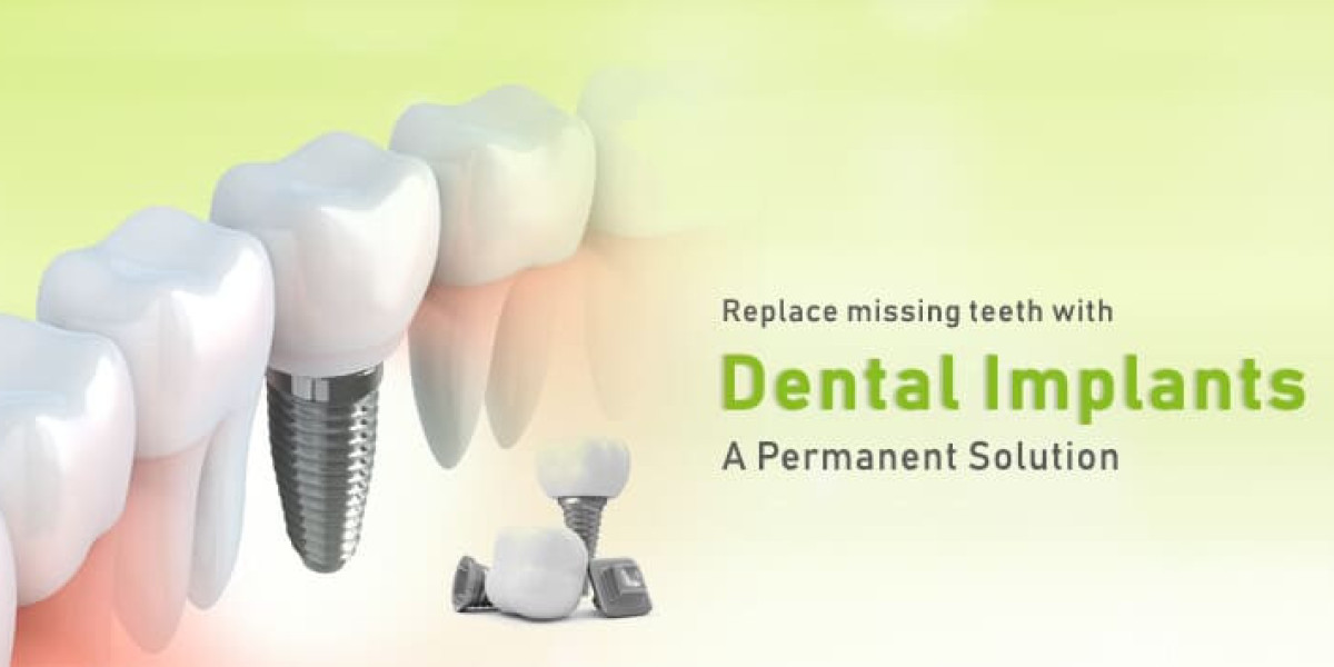 Aesthetic Smile Dental Clinic: Best Dental Implant Clinic in India