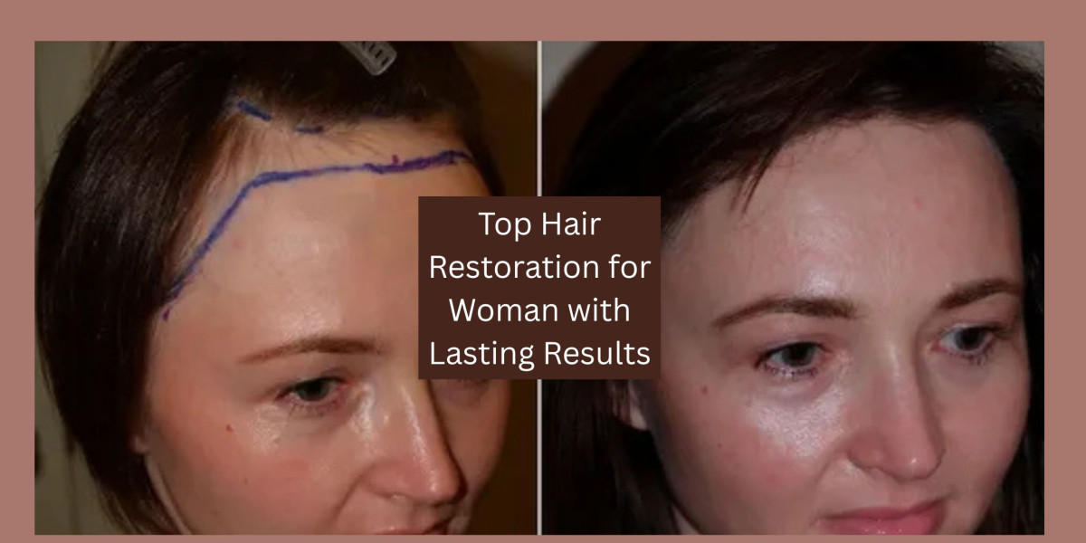 Top Hair Restoration for Woman with Lasting Results